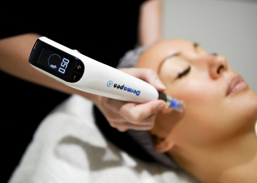 Microneedling