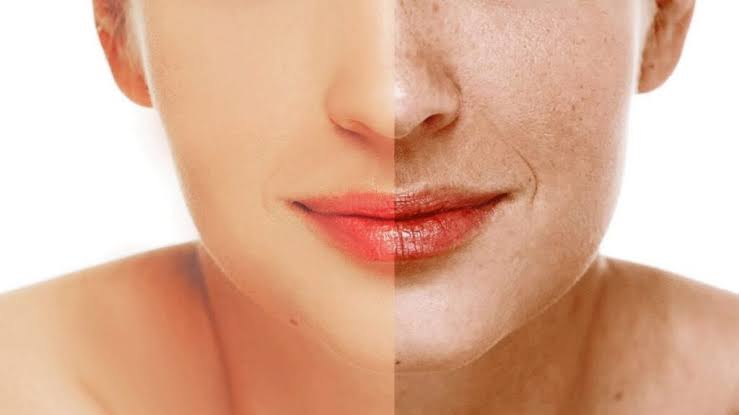 Aesthetic & corrective