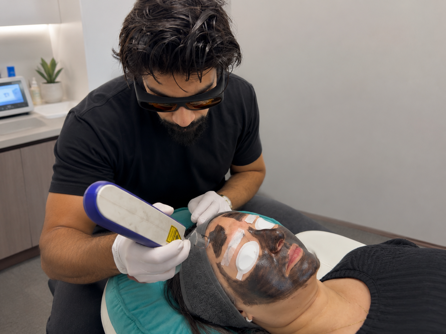 Carbon Laser Peel