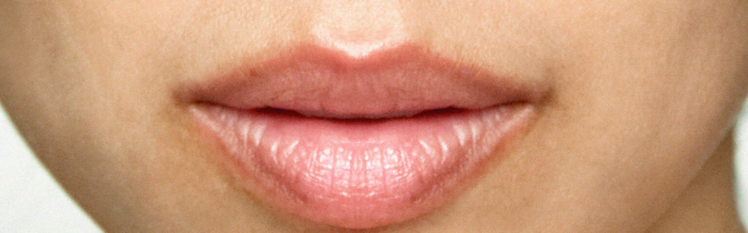 DermaPen – NovaMed Aesthetics Studio