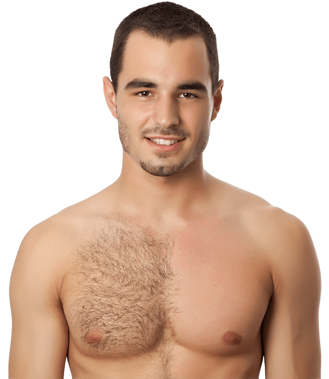 Hair removal for men